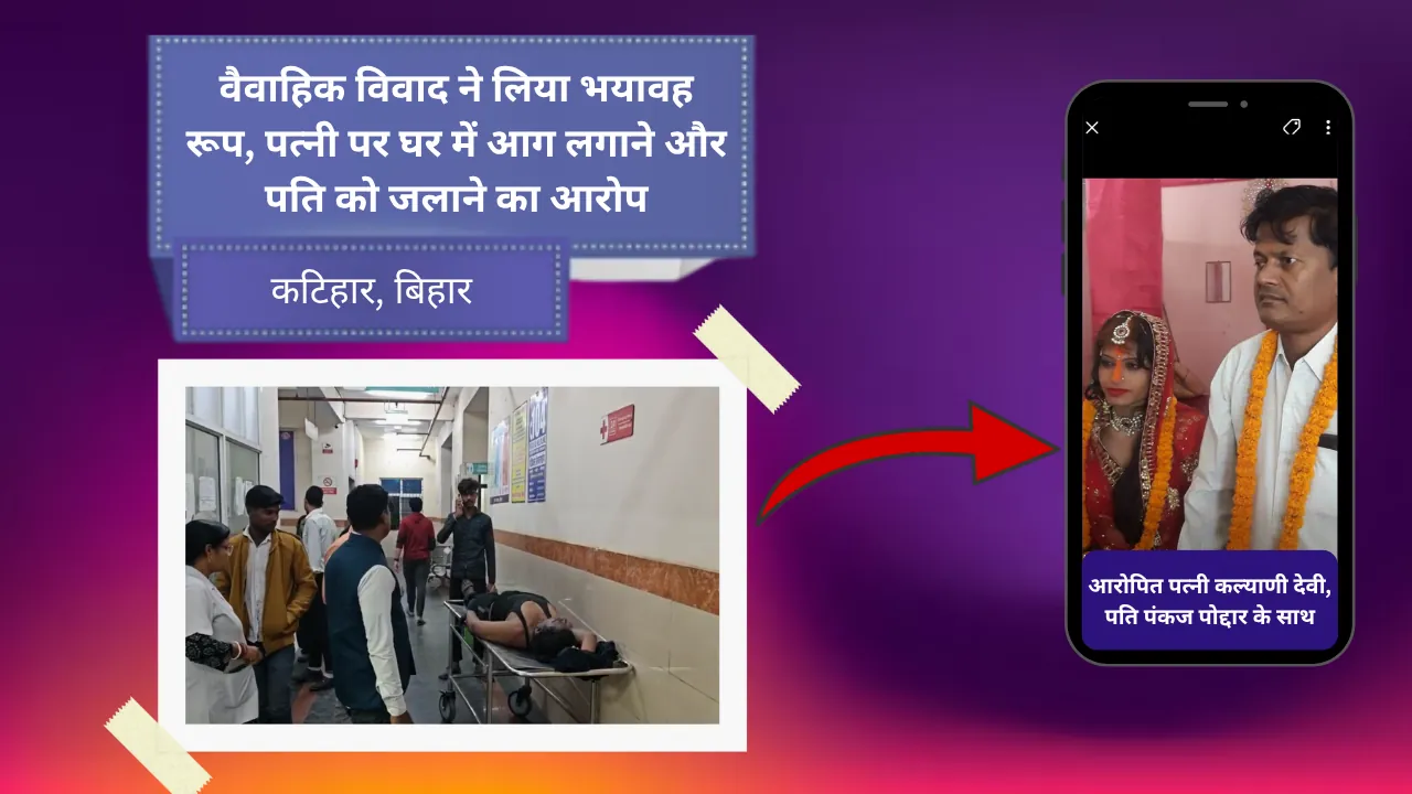 कटिहार में वैवाहिक विवाद ने लिया भयावह रूप, पत्नी पर घर में आग लगाने और पति को जलाने का आरोप