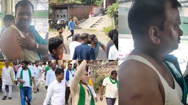 RJD प्रत्याशी पर जानलेवा हमला: पत्थरबाजी में 4 समर्थक जख्मी, बाल-बाल बचे लल्लू मुखिया 